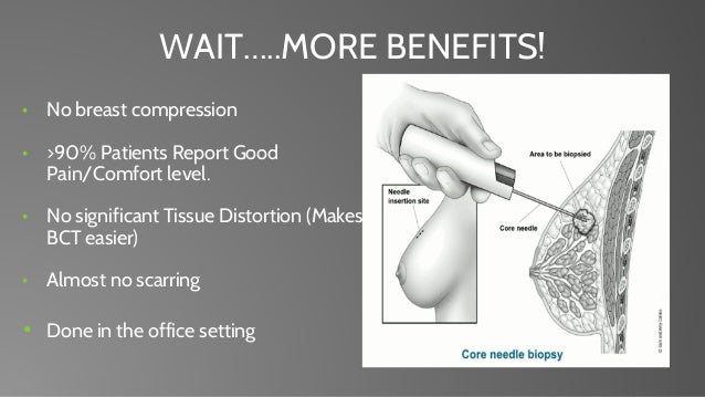 breast needle biopsy ultrasound Nude xmas teens